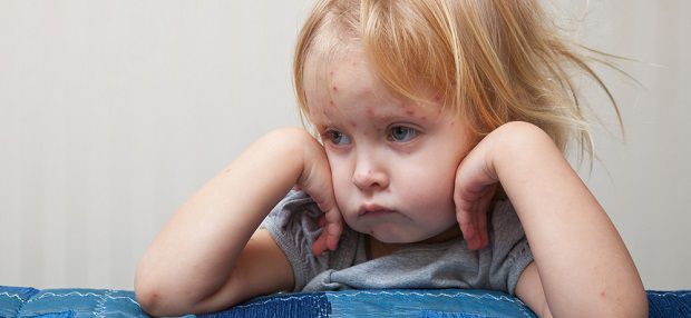 Изображение Лечим сыпь на коже на Schoolofcare.ru!